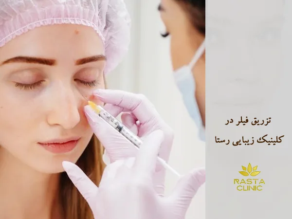 تزریق فیلر در اصفهان