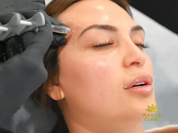 تزریق فیلر شقیقه
