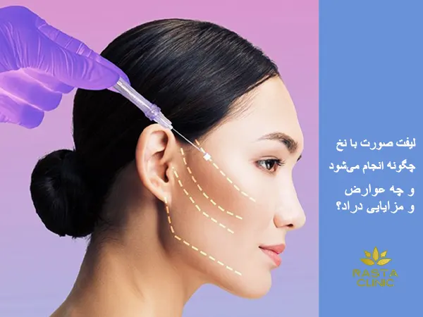 لیفت صورت با نخ چگونه انجام می‌شود و چه مزایا و عوارضی دارد؟