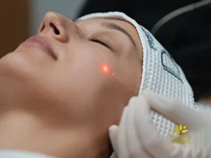 هزینه جوانسازی پوست صورت و بدن با لیزر اندولیفت در کلینیک رستا اصفهان