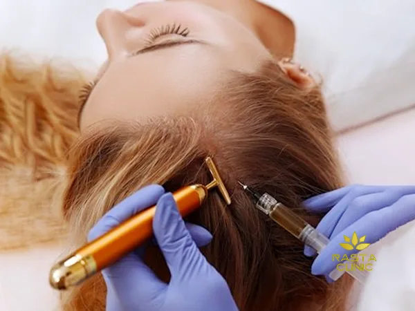 هزینه مزوتراپی مو در اصفهان