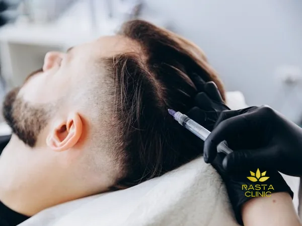 مزوتراپی مو در اصفهان