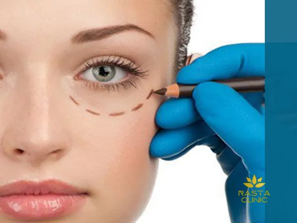 تزریق فیلر زیر چشم چیست