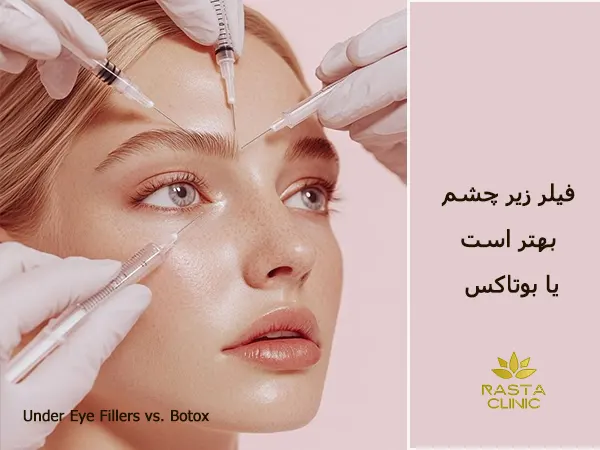 فیلر زیر چشم بهتر است یا بوتاکس