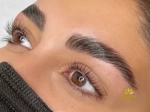 لیفت ابرو با مواد