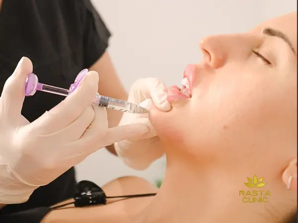 تزریق فیلر چانه در اصفهان