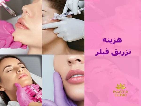 هزینه تزریق فیلر
