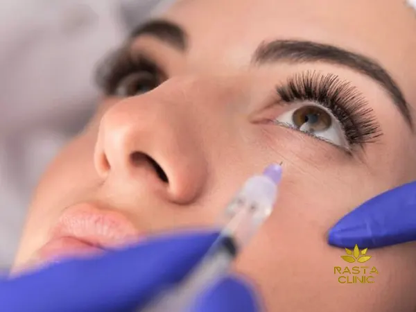 قیمت فیلر زیر چشم
