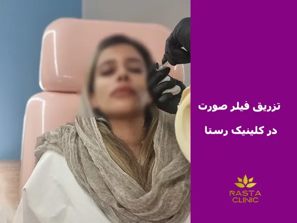 تزریق فیلر صورت