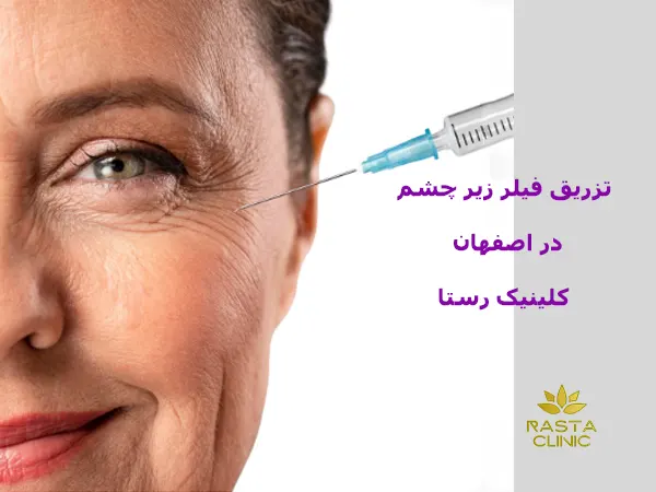 تزریق فیلر زیر چشم در اصفهان